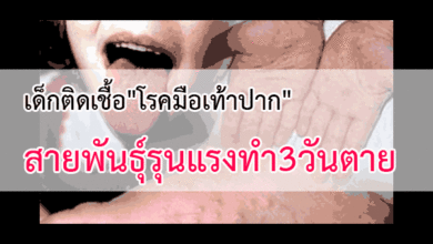 โรคมือเท้าปาก